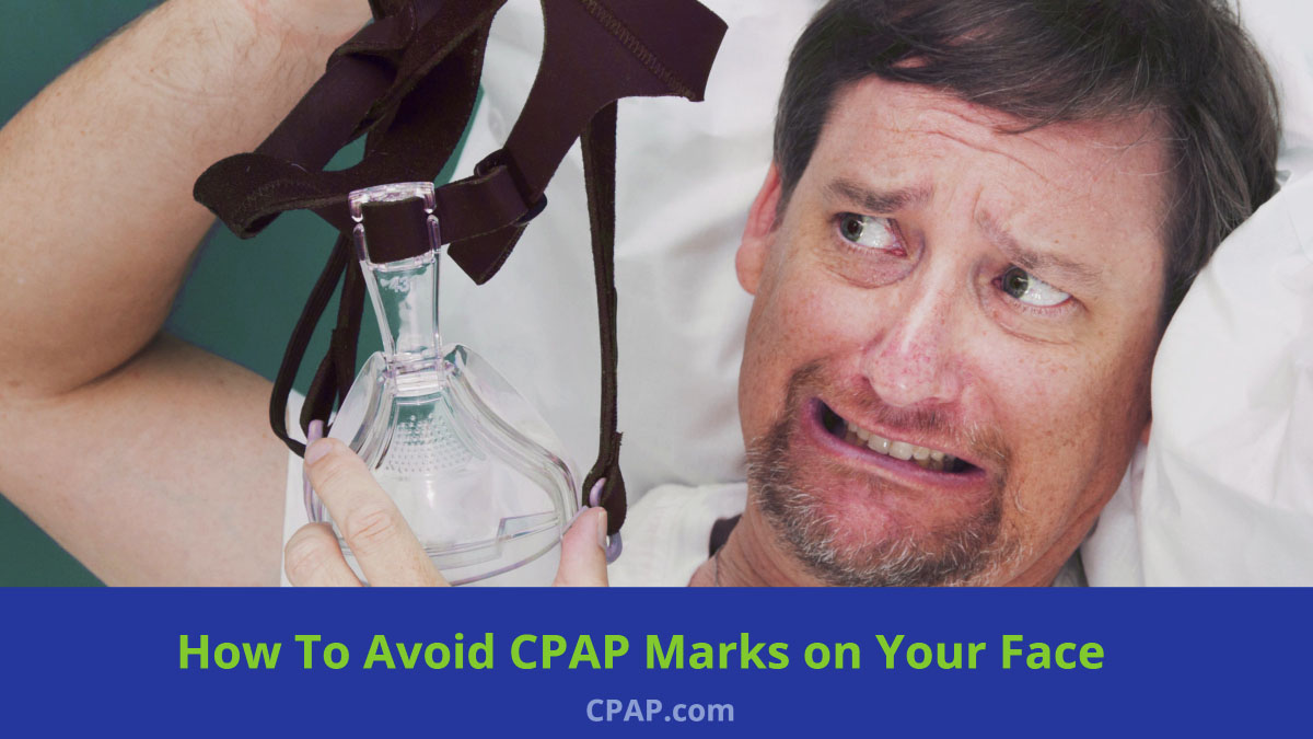 How to Get Rid of CPAP Marks and Lines on Your Face From a CPAP Mask