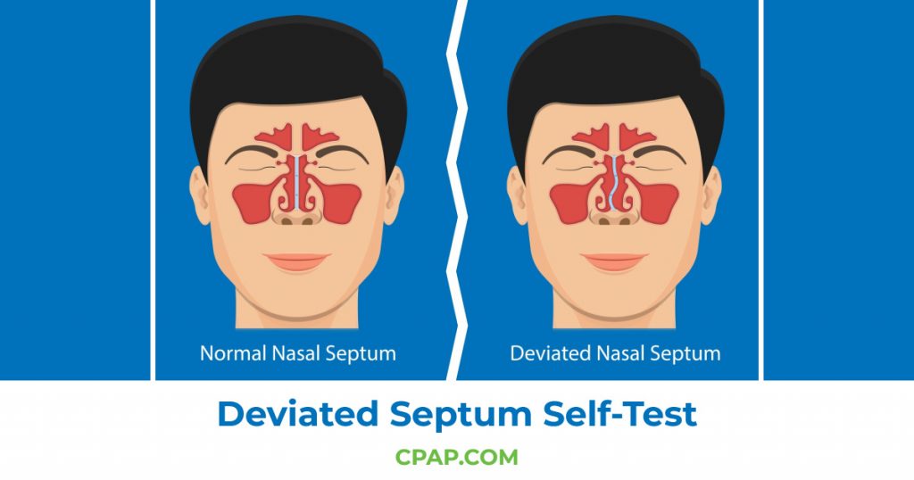 deviated septum self test