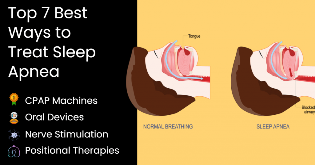 Illustration of obstructive sleep apnea and treatment device options