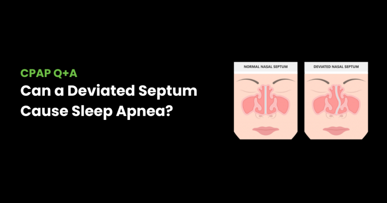 Illustration of deviated septum and sleep apnea correlation
