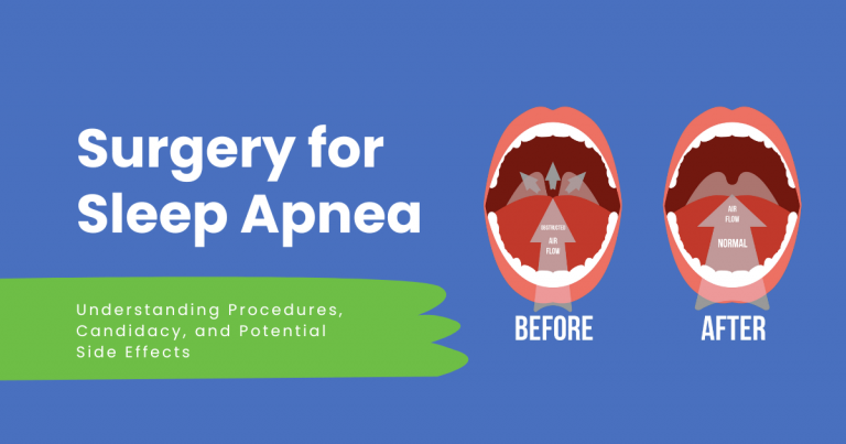 Surgery for sleep apnea before and after illustration