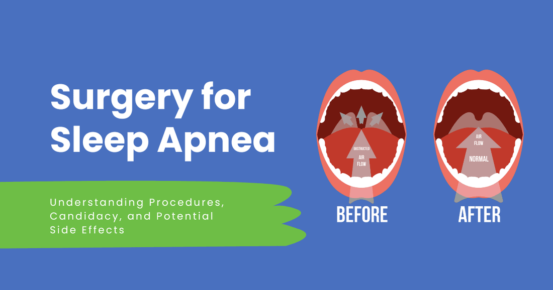 Surgery Cpap Surgical Treatment Options for Sleep Apnea: Understanding Procedures ...