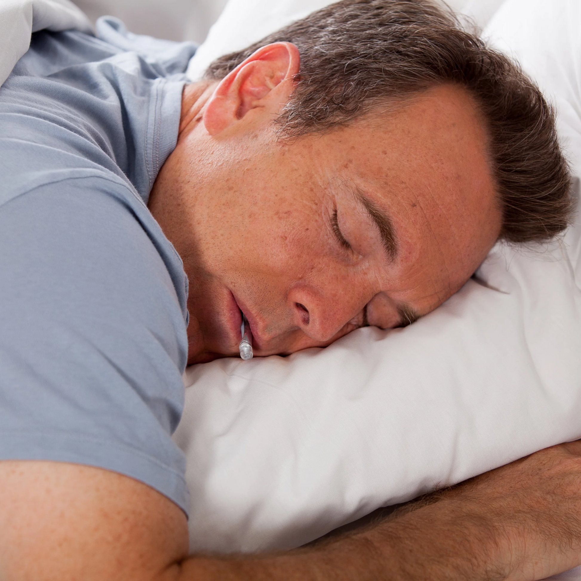 myTAP Oral Appliance for Sleep Apnea